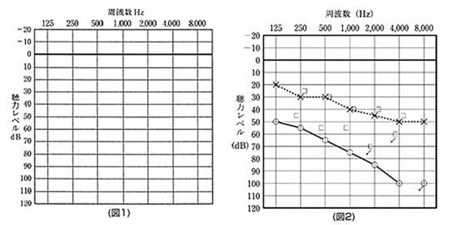 正しい規格のオージオグラムとその記載例